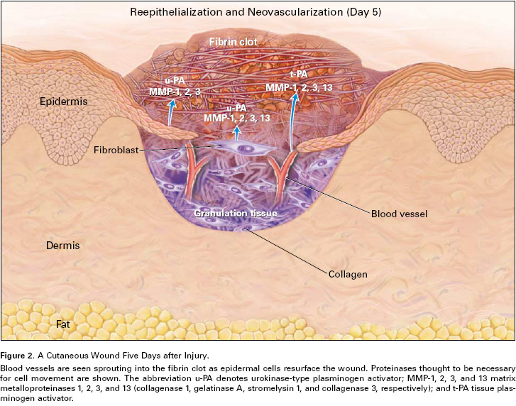 improved-dermal-wound-healing-wound-healing