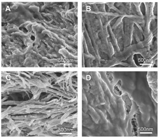 Use of Nanomaterials for Bone Regeneration