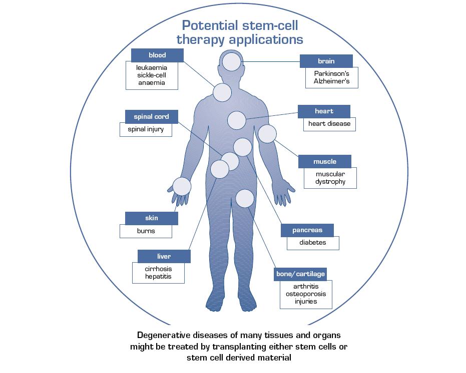 Stem Cell Therapies