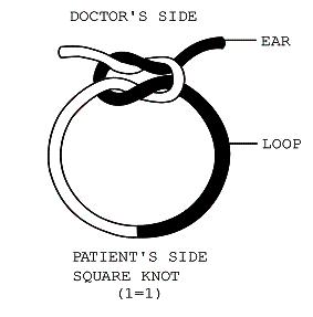 Suture knot