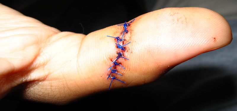Non-absorbing suture