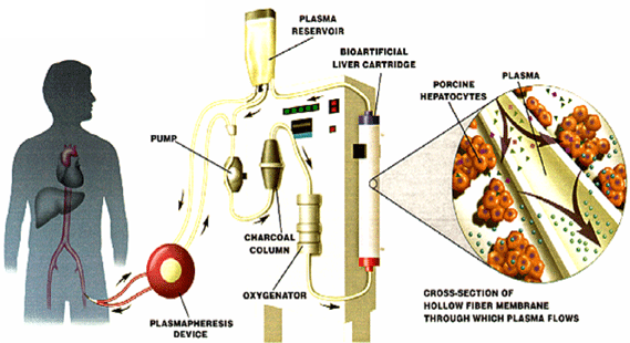 Artificial Liver