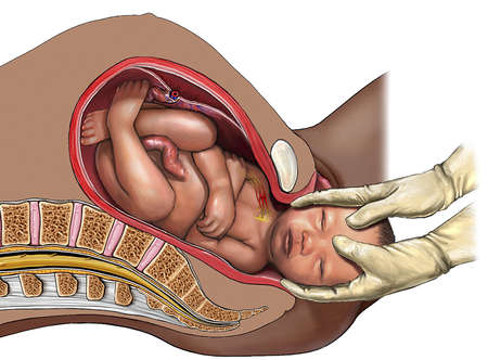 obstetric