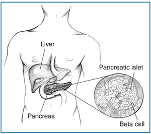 Drawing of a body torso showing the location of the liver and the  pancreas with an enlargement of a pancreatic islet containing beta  cells.
